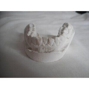 Vintage Cast Dental Teeth Mold  Tooth Castings Medical Oddity #1